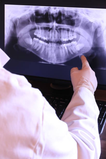Best Emergency Dentist for Knocked-Out Tooth in New Lno, LA